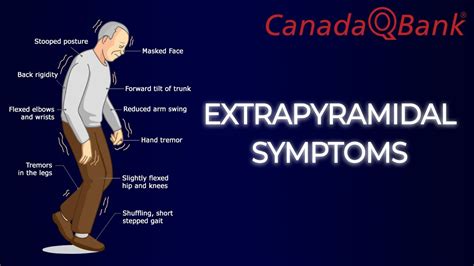 Extrapyramidal Symptoms - YouTube