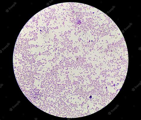 Premium Photo | Staphylococcus aureus bacteria colonie gram stain ...