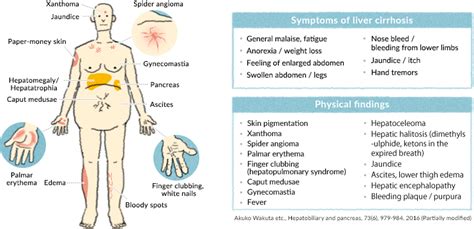 Liver Pain Symptoms Location