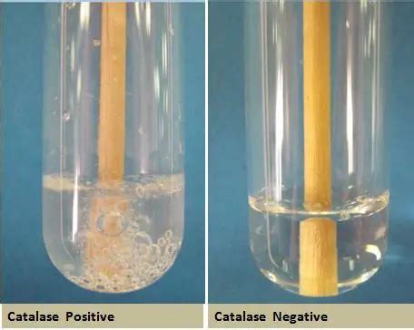 Catalase test: Principle, Procedure, Results, Uses • Microbe Online