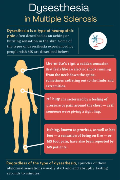 Dysesthesia in MS | Feeling, Causes, and Treatment | Multiple Sclerosis ...