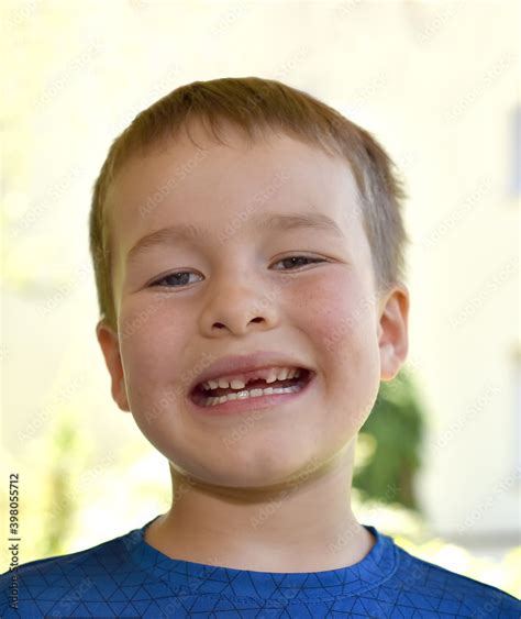 Little boy smiling without one tooth. Portrait of a laughing toothless ...