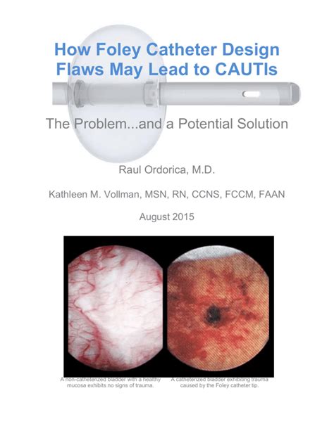 Foley catheter complications – Prnso