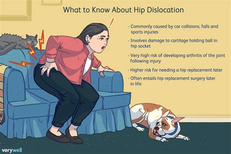 Dislocated Hip: Alignment Injuries, Pain, Surgery, Recovery