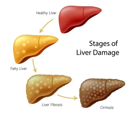 29 Best Foods to Protect You From Liver Disease 2022 | EHN