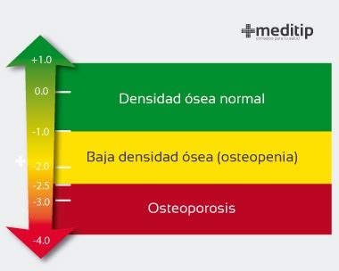 Densitometría ósea: qué es y qué enfermedades puede detectar