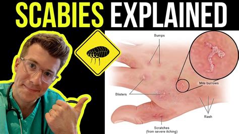 What do scabies look like? – Tipseri