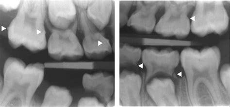 14: Periodontal Conditions | Pocket Dentistry