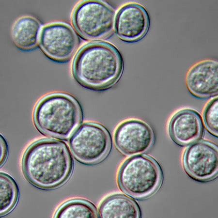 Identifying Fungi & Actinomycetes in Microscopic Settings | Study.com