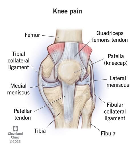 Knee Pain Cause - Ask The Nurse Expert