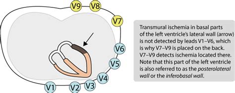 The ECG leads: electrodes, limb leads, chest (precordial) leads, 12 ...