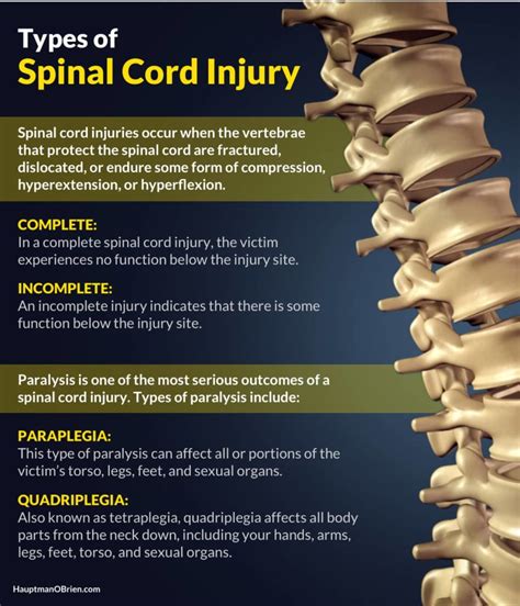 Spinal Cord Injury Lawyers | Omaha, Nebraska