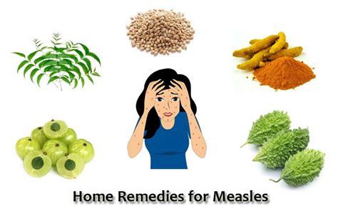 Paano maka-iwas sa tigdas o measles? | Mediko.ph