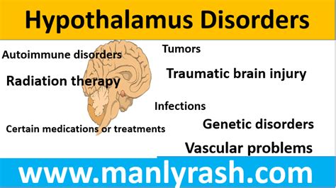 What Is the Hypothalamus and Why Is It Crucial for Your Health - We ...