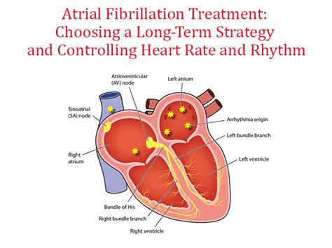 Atrial Fibrillation Treatment - Afib Treatment | Dr C Raghu