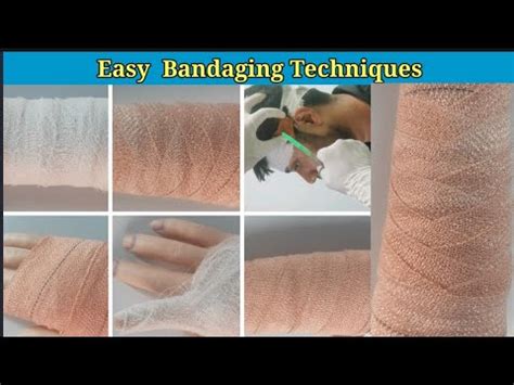 Bandaging Procedure | All Types of Bandaging Techniques | Medical ...