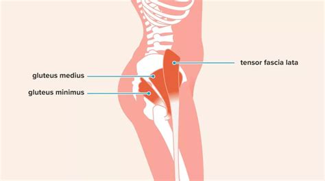 Quick Facts on Gluteal Tendinopathy | Kinetic Labs