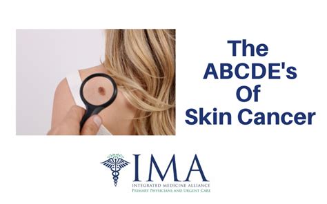 ABCDE's of Skin Cancer - Integrated Medicine Alliance