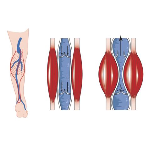 The Calf Muscle Pump & Compression - Venosan USA