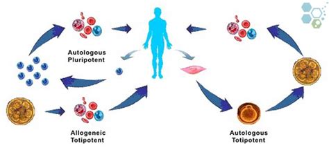 Allogeneic Stem Cells & Allogeneic cell transplantation