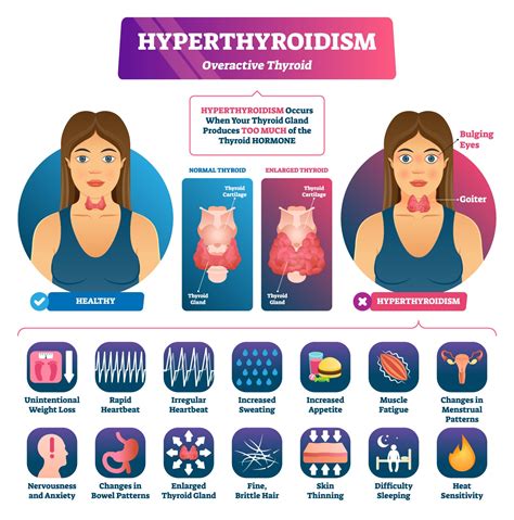 Thyroid Dysfunction Presentation