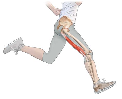 Hamstring Injuries | Biceps Femoris | Semitendinosus | Semimembranosus