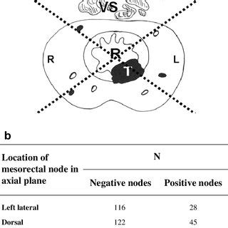 (PDF) Location of involved mesorectal and extramesorectal lymph nodes ...