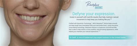 Restylane Defyne Midtown - Restylane Defyne Midtown NYC – Best ...