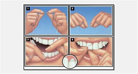 Why Flossing is Important? - Normanhurst Dental