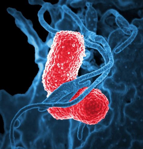 Bacteria Domain – All Classification Of Bacteria. - GuideBasics