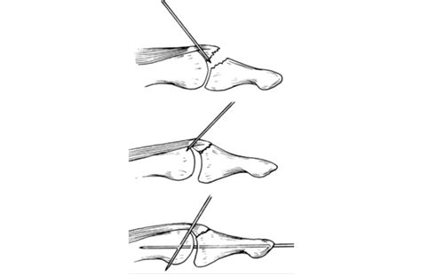 Procedures by Dr. James Chen