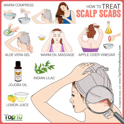 Pimples On Chin Home Remedies: Scalp Scabs Home Remedies