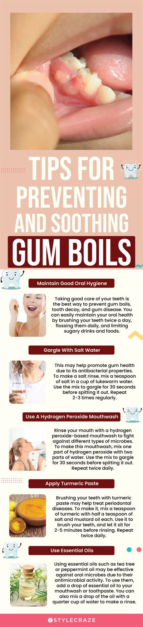 Gum Boil: Symptoms, Natural Remedies, And Medication