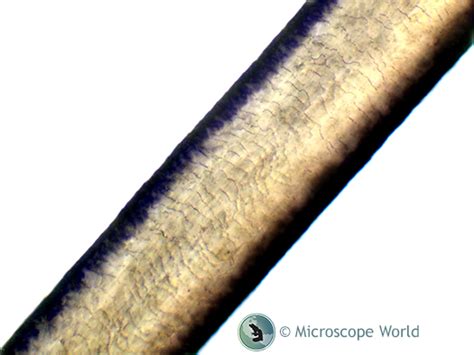 Hair Analysis under the Microscope