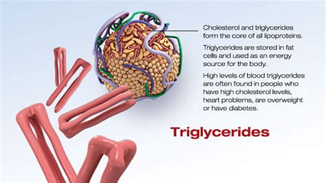 High triglycerides causes, symptoms, high triglycerides diet and treatment