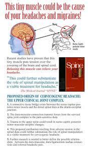 17 Best images about Cervicogenic Headache on Pinterest | Back pain ...