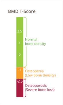 Bone Mineral Density Scan | My Doctor Online