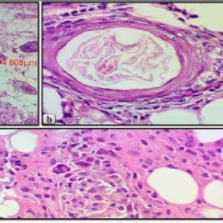 Averaged thickness (μm) of the skin layers (epidermis, dermis, and ...