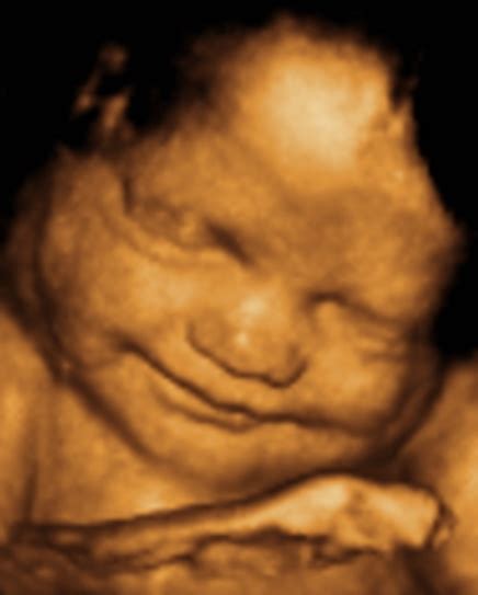 Ultrasound Photo Gallery, 3D Photos by Week. Statesville NC Sonogram