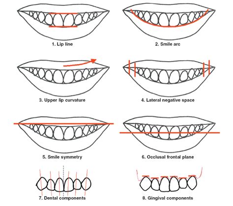 Our Results | Jaw Alignment | Bovenizer & Baker Orthodontics in Cary, NC