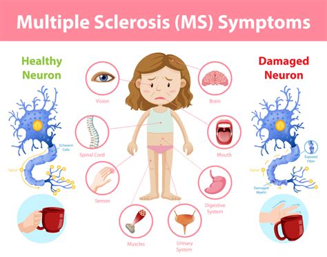 Nursing Care Plans For Multiple Sclerosis With Examples | The Study Corp