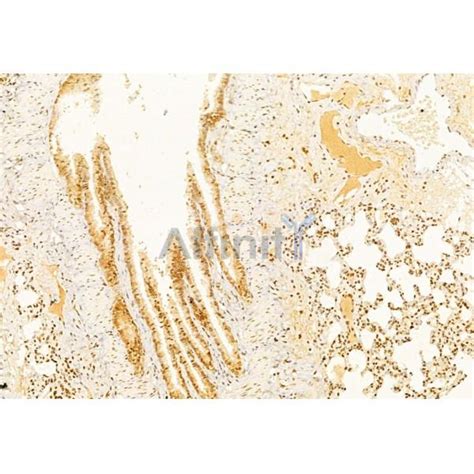 Caspase 3 Antibody | Affinity Biosciences