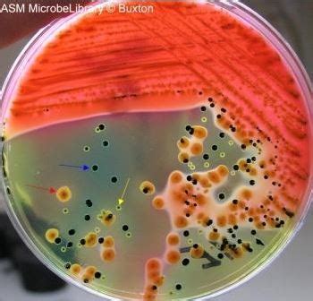 Hektoen Enteric (HE) Agar: Composition, Uses • Microbe Online