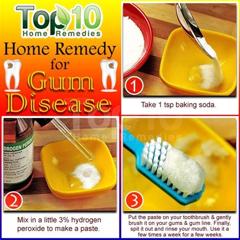 Home Remedies for Gum Disease | Top 10 Home Remedies