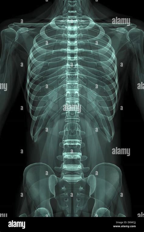 X-Ray image showing the rib cage and pelvis Stock Photo - Alamy