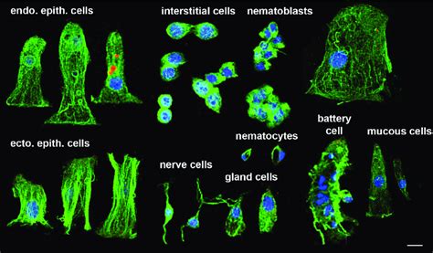 Identification of the various cell types in Hydra. Macerated tissues ...