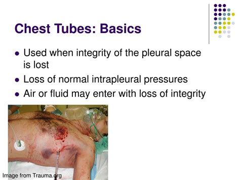 Chest Tube Animation