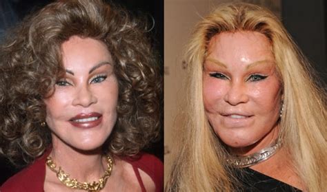 10 Celebrities Who Were Almost Unrecognisable After Plastic Surgery