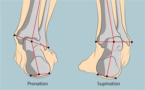 Pronation vs. Supination | Diversified Integrated Sports Clinic