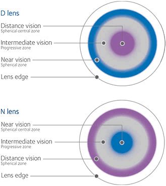 The New Biofinity Multifocal Fitting Guide - Eyedolatry